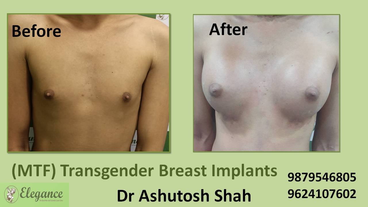 Perfect trans boobs