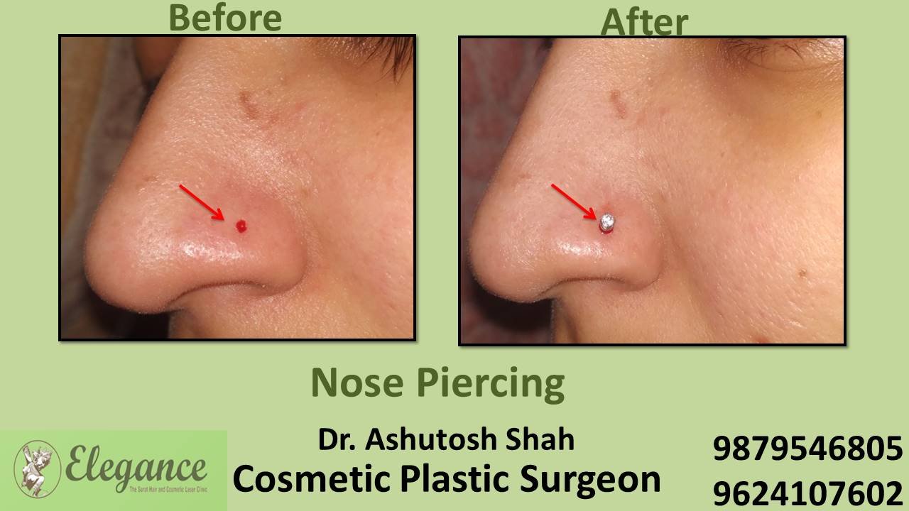 Nose Piercing in Surat, Gujarat (India)