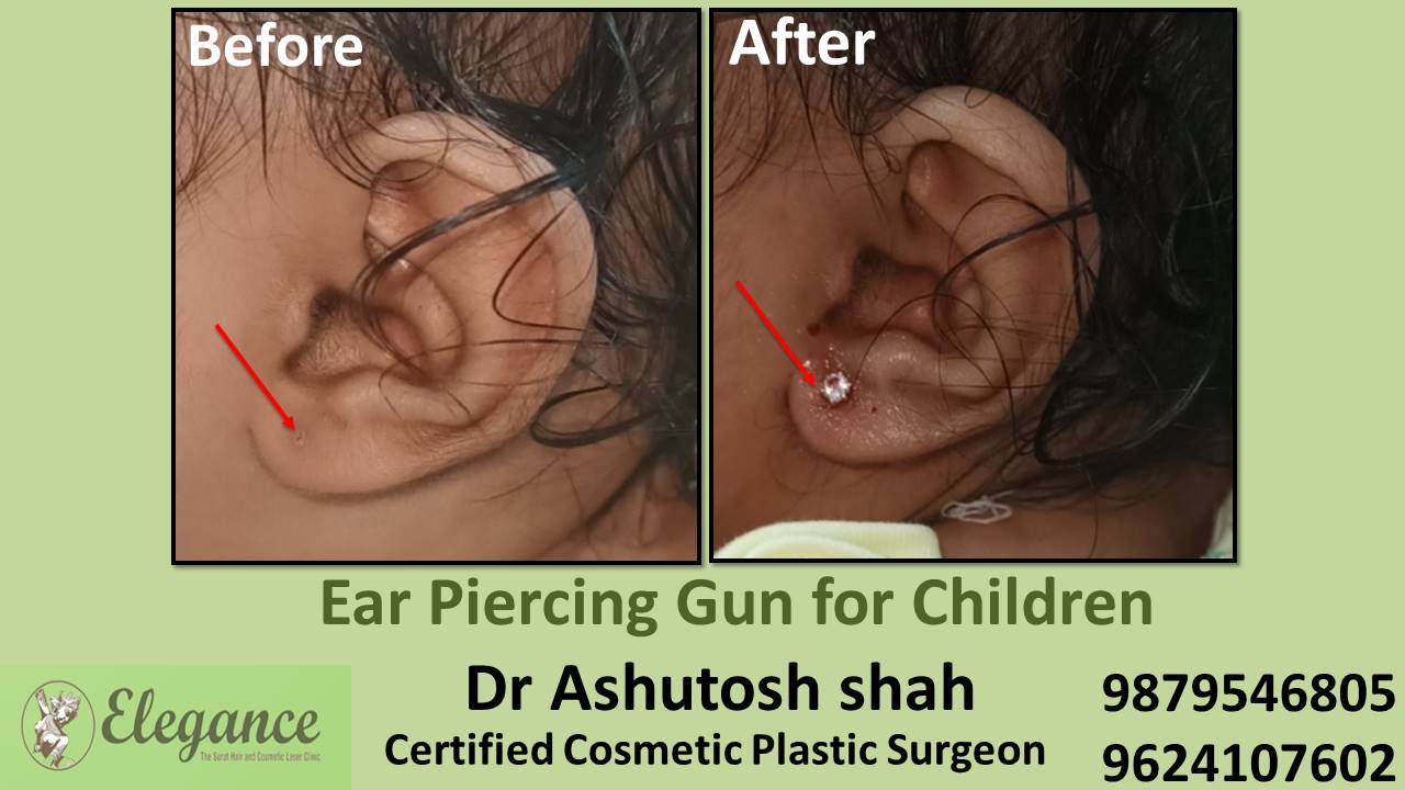 Ear Piercing in Surat, Gujarat (India)