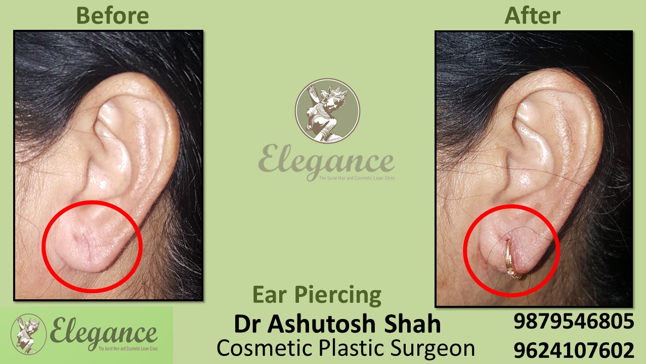 Ear piercing in Bharuch, Valsad, Surat