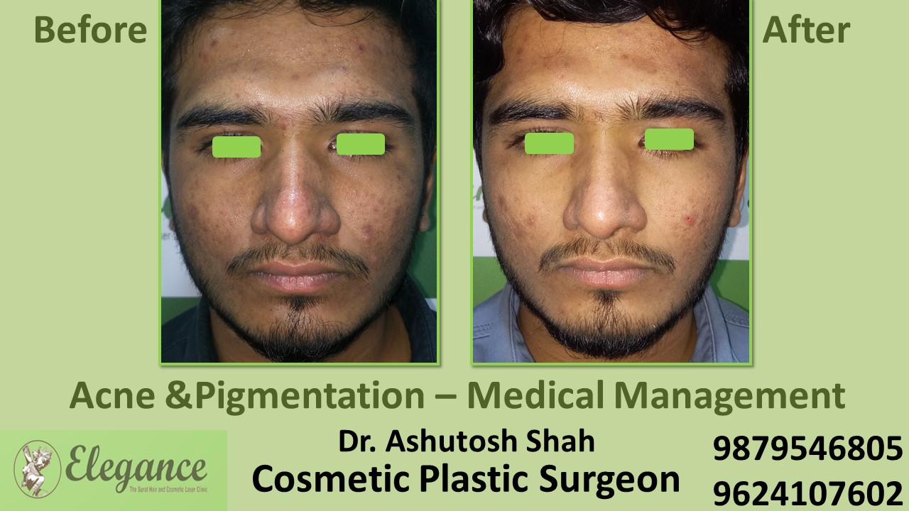 Facialmakeover Treatment In Surat, Valsad, Vapi, Gujarat.