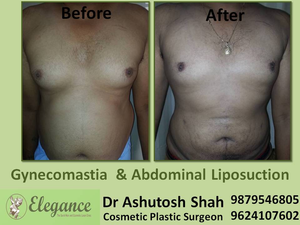 Tummy Fat Reduction near, Valsad, Vapi, Gujarat