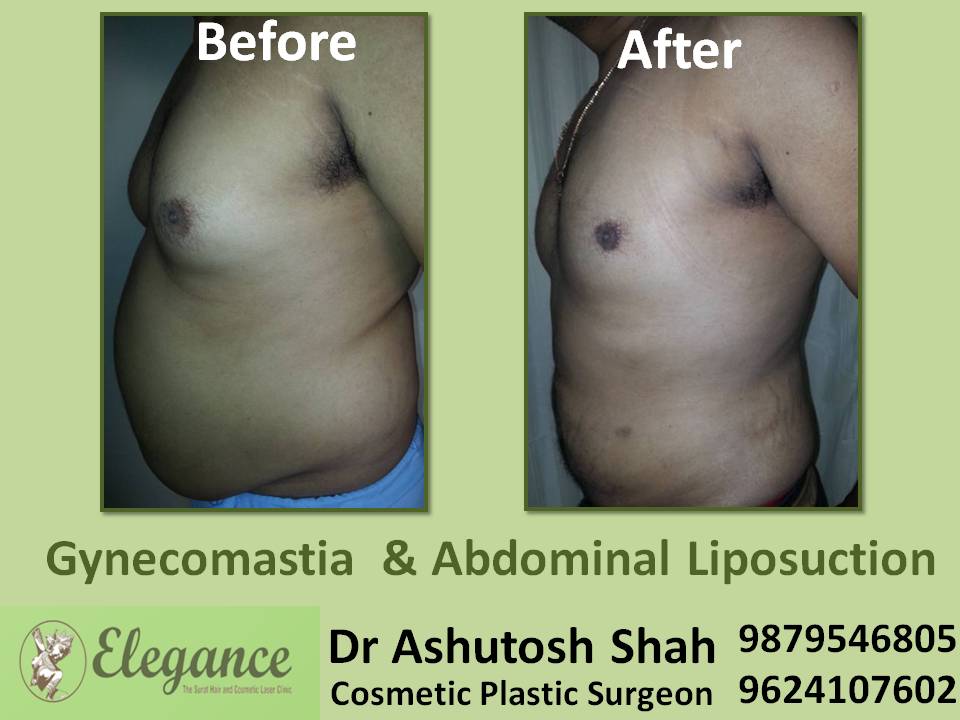 Belly Fat Reduction Near Mumbai, Nasik