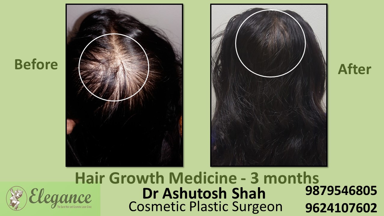 Doctors for Hair Growth with Medication in Ankleshwar, Gujarat