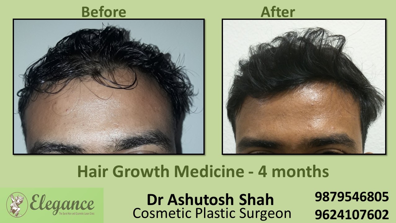 Doctors for Hair Growth with Medication in Bharuch, Gujarat