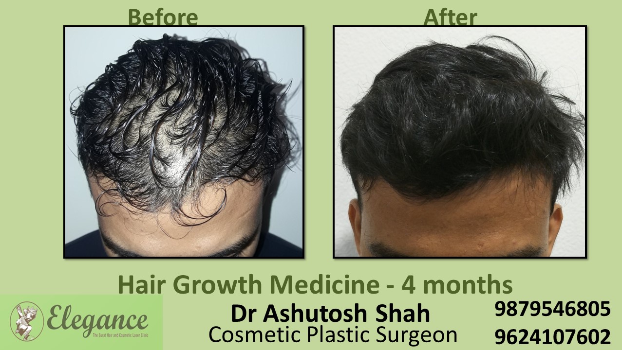 Doctors for Hair Growth with Medication in Valsad, Gujarat