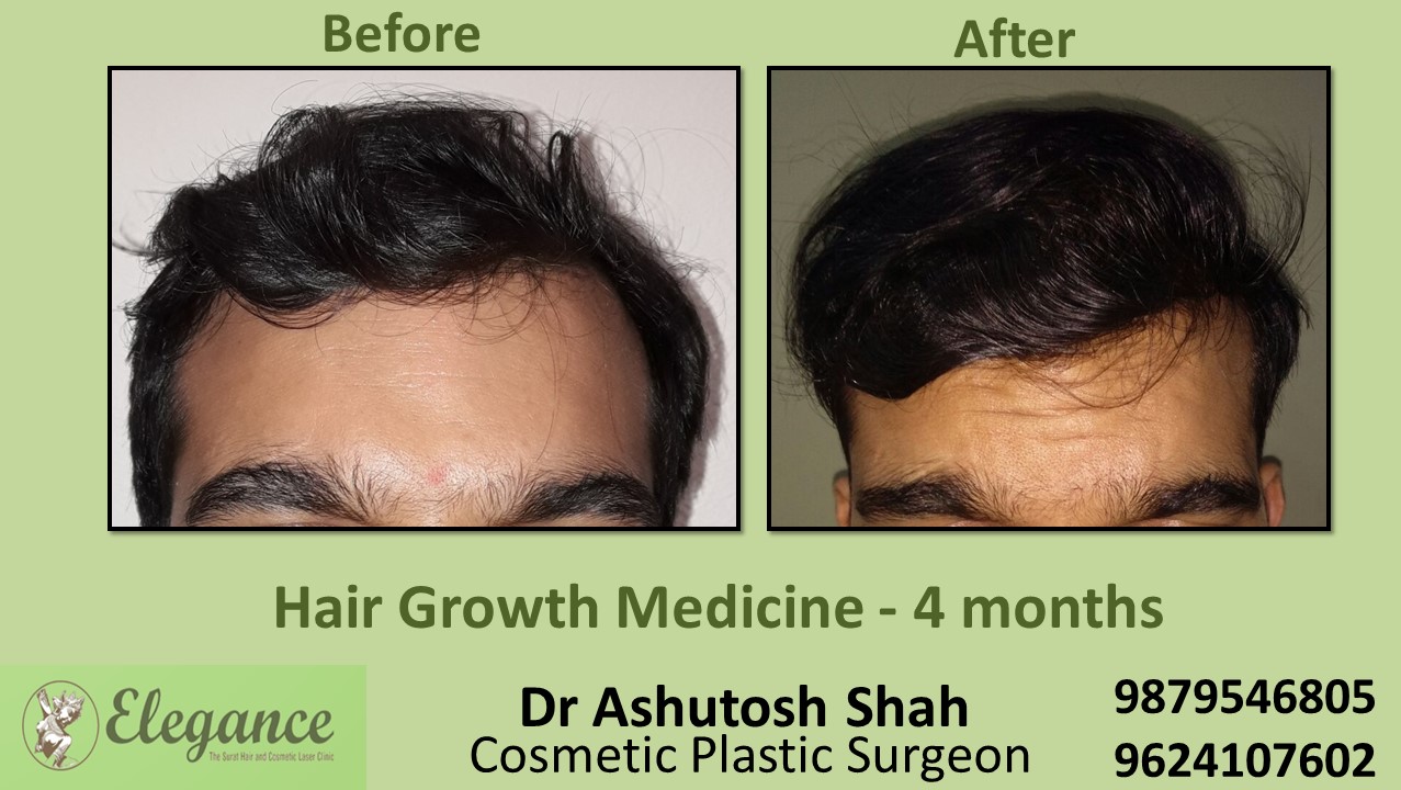Doctors for Hair Growth with Medication in Vapi, Gujarat