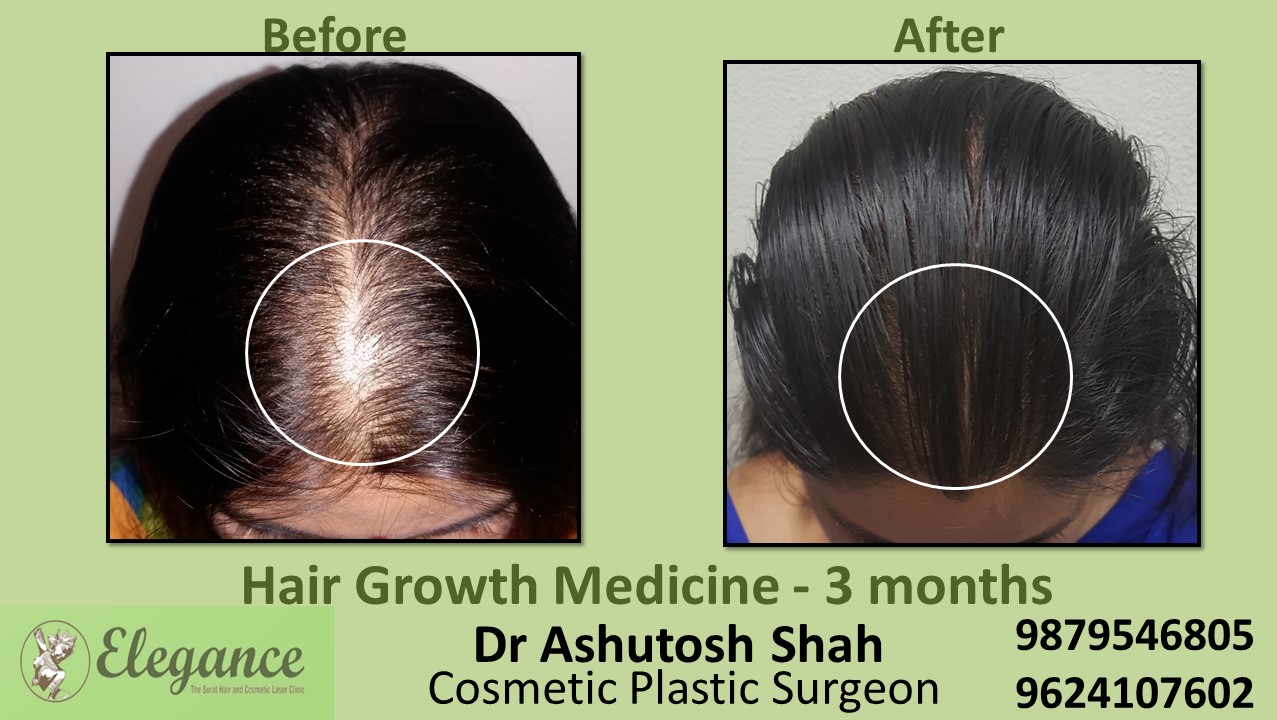Doctors for Hair Growth with Medication in Vapi, Gujarat